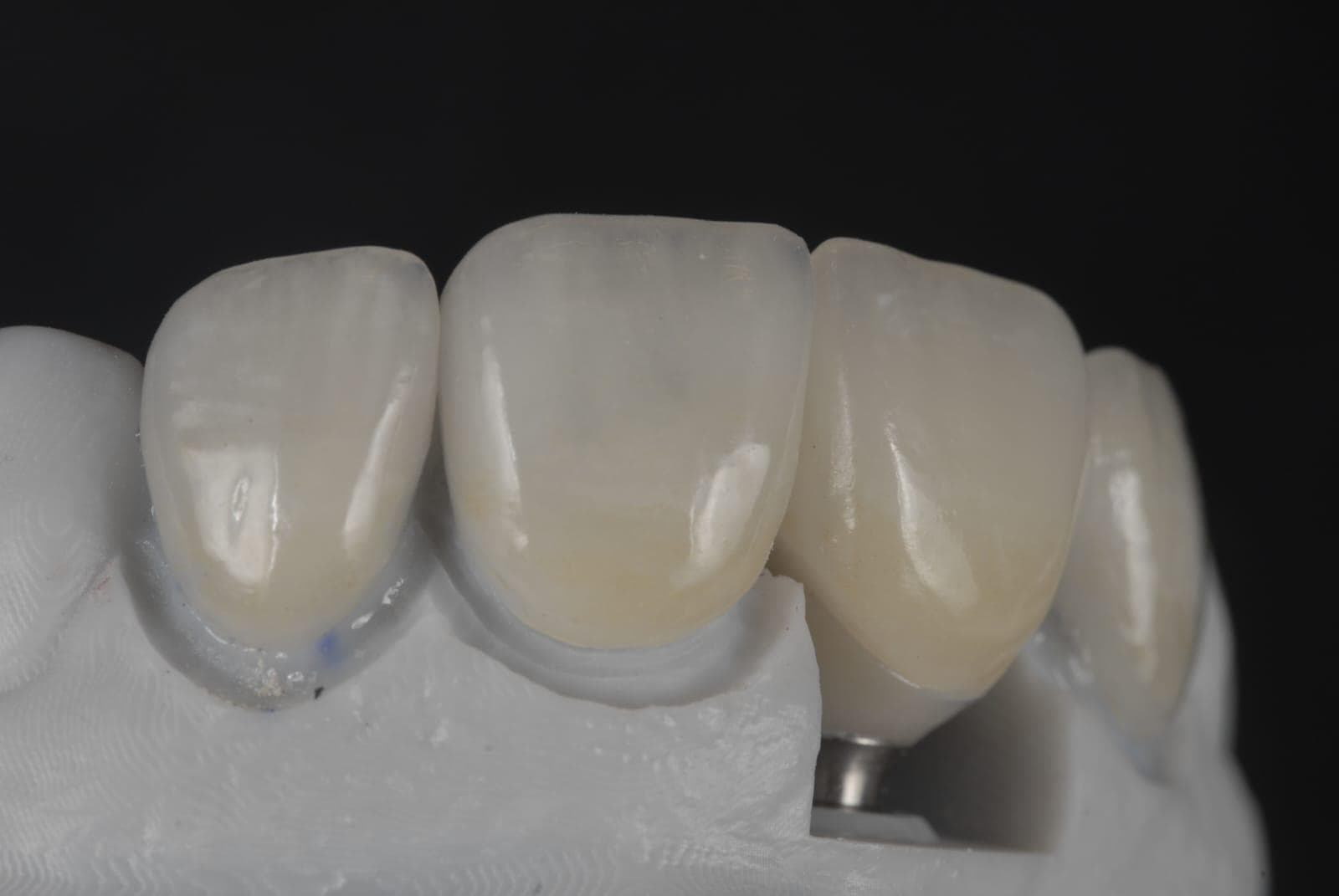 Everything a Dental Lab Business Needs, Ready to Go.