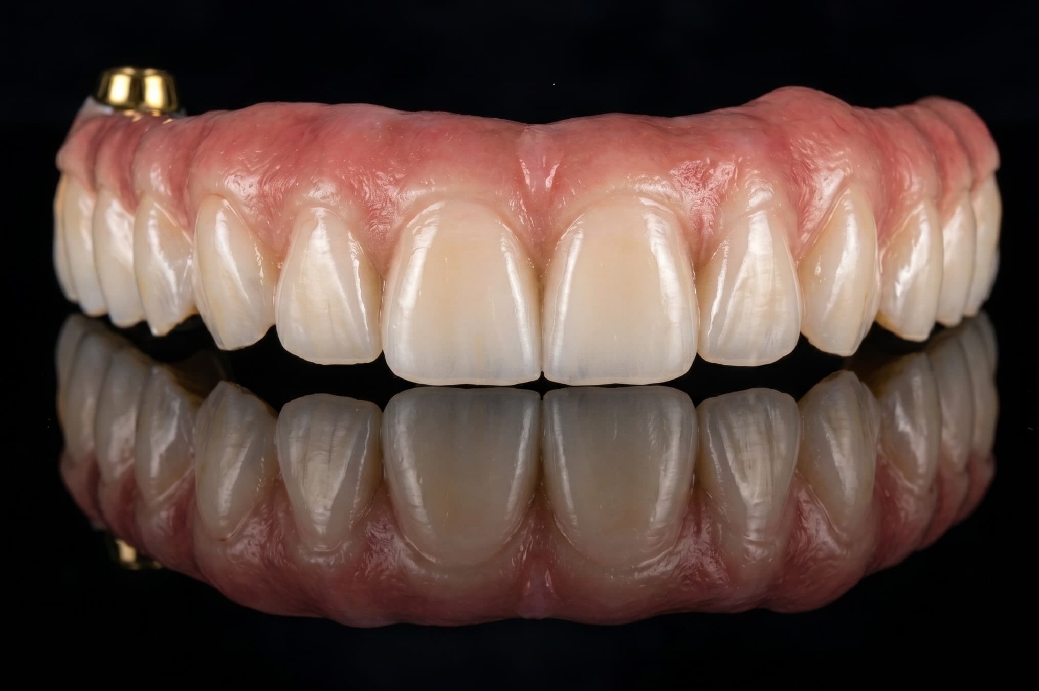 Full Arch Zirconia